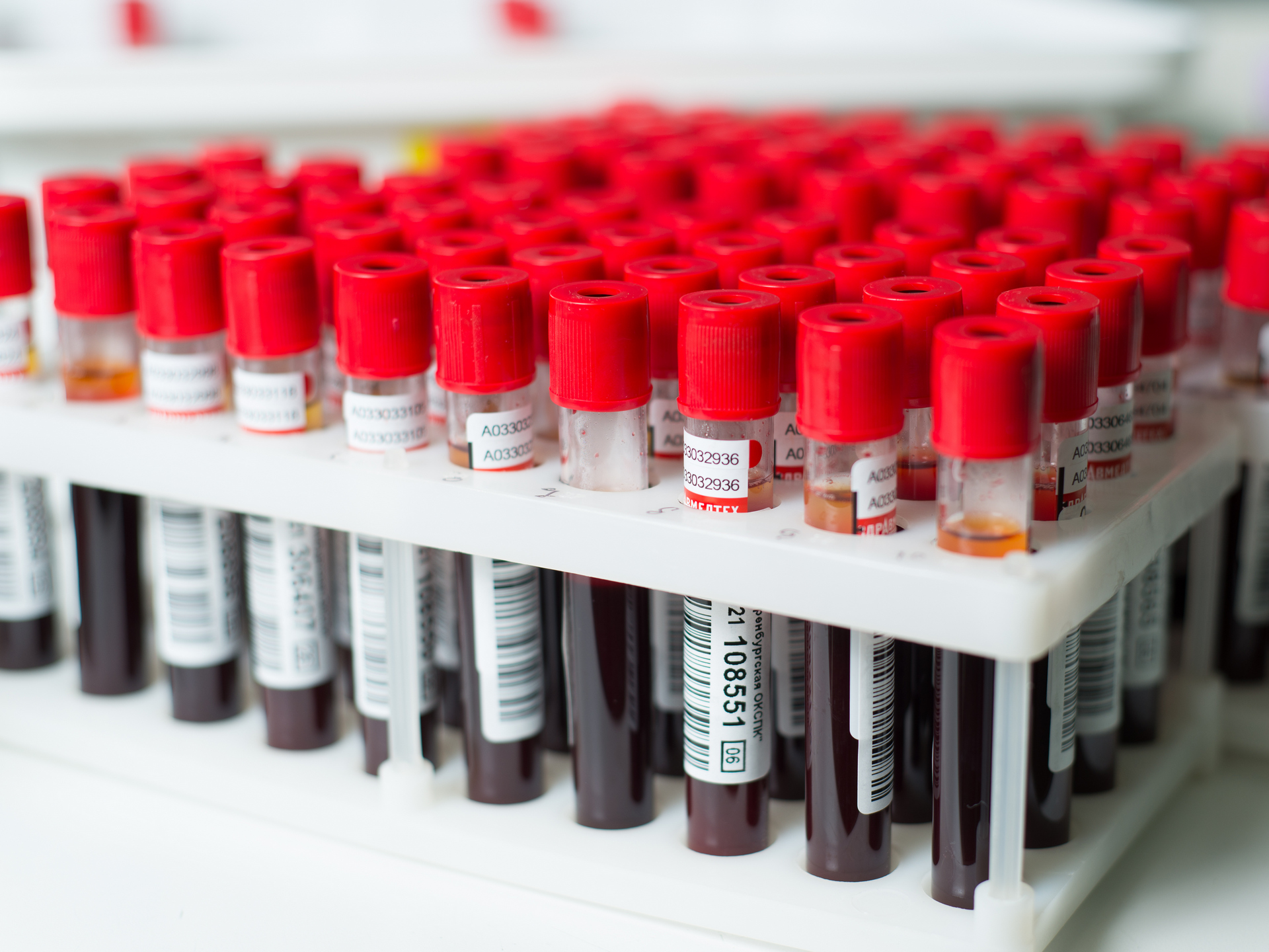 ГБУЗ "ООКСПК" предоставляет широкий спектр исследований крови